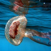أعراض وطريقة علاج لدغة قنديل البحر